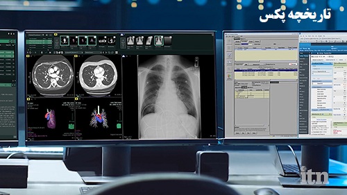 تاریخچه پکس